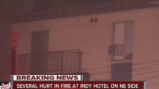 5 hospitalized after hotel fire, 40 evacuated