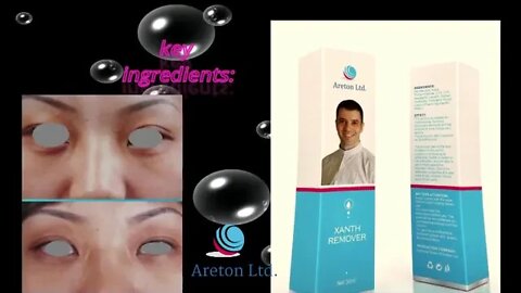 Syringoma Removal - Glycolic Acid Peel XanthRemover easy & effective peel to Remove Syringoma