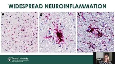 Neuropathology of SARS-CoV-2 Infection in Aged Non-human Primates