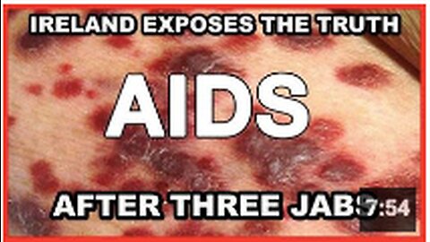 Ireland and other countries expose the truth that after THREE JABS, you will TEST POSITIVE for AIDS