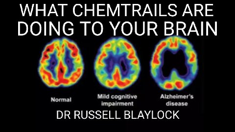 Dr. Russell Blaylock: Extreme Illness Caused by Aluminum Nanoparticles From Chemtrails