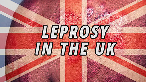 Leprosy Cases in the United Kingdom | Covid Shot + Leprosy