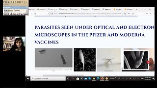 4 Parasites Found In Pfizer Moderna Covid-19 - 10-14-21