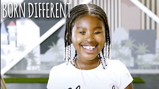 The Girl Born With No Eyes | BORN DIFFERENT