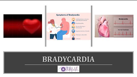 BRADYCARDIA - CAUSES AND SOLUTIONS | True Pathfinder