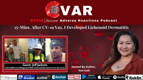 15 Mins After Covid Vaccine, I Developed Lichenoid Dermatitis - Jeff Jackson