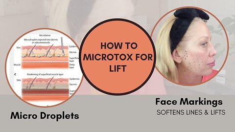 Microbotox my Face - Full Video