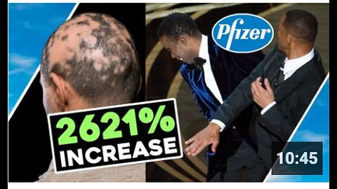 Pfizer SLAP Stunt HAIR LOSS 2621% ⬆ INCREASE