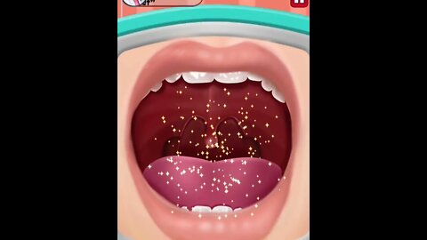 Removal of tonsils. #shorts #kids #games