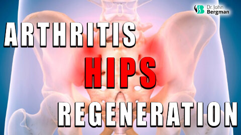 Hip Arthritis & Hip Regeneration