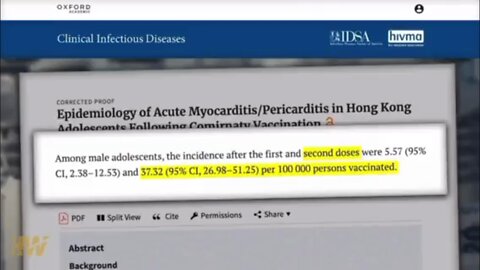 Dr Robert Malone: "Subclinical myocarditis may be occurring in the majority of vaccine recipients"