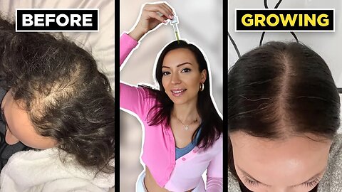 The BEST oils for hair growth (+ how to beat hair loss naturally for thicker hair)