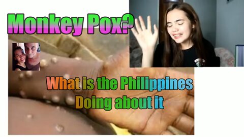 PH TIGHTENS BORDER CONTROLS AMID MONKEYPOX DOH & BOQ ON STAND BY