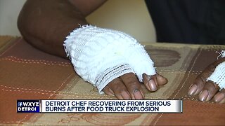 Detroit chef recovering from serious burns after food truck explosion
