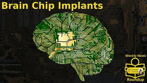 Brain Chip Implants