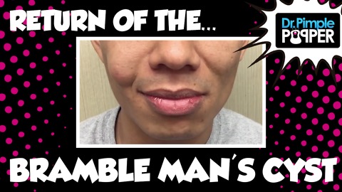 Return of the Cyst: with Bramble Man