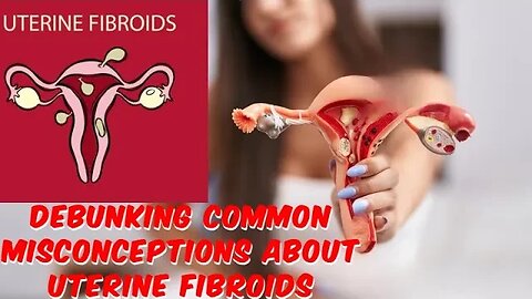 Debugging Common Misconceptions About Uterine fibroids