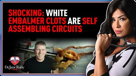 Dr. Jane Ruby SHOCKING: White Embalmer Clots Are Self Assembling Circuits