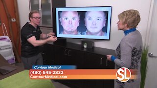 Contour Medical explains how they can give you smoother, younger looking skin