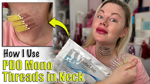 How I Use PDO Threads to Rejuvenate my Neck, AceCosm| Code Jessica10 Saves you Money