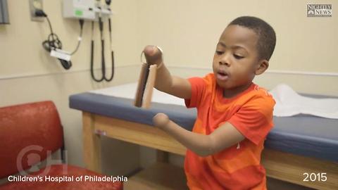 Child Receives First Double Hand Transplant In The US