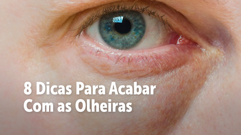 8 Dicas para acabar com as olheiras