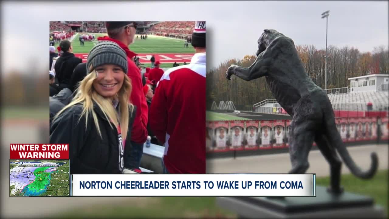 Norton cheerleader opens eyes, moves hand after 3 weeks in coma