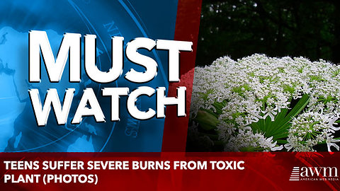 Teens Suffer Severe Burns From Toxic Plant (Photos)