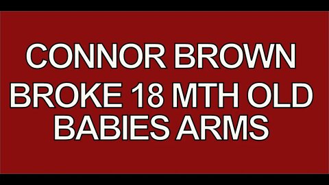 broke babies arms