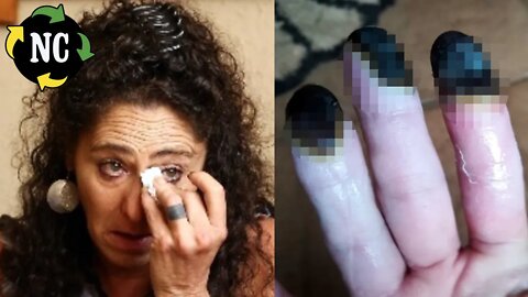 Manicure fica com os dedos pretos e médicos dão notícia terrível. Em seguida ela faz um alerta
