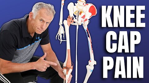 Top 3 Stretches for Patellofemoral Syndrome or knee cap pain
