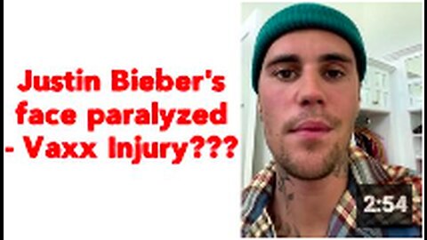 Justin Bieber's face paralyzed - Vaxx Injury???