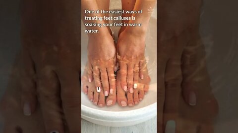 How to Get Rid of Calluses at Home #shorts