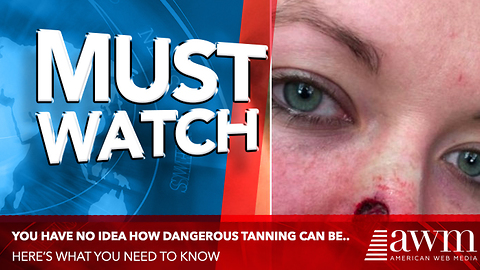 It Started Out As A Tiny Dot But It Ends Up Much Worse. The Cause Is Very Common. Hear Her Warning