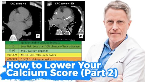 How to Lower Your Calcium Score (Part 2): Fix the Root Causes