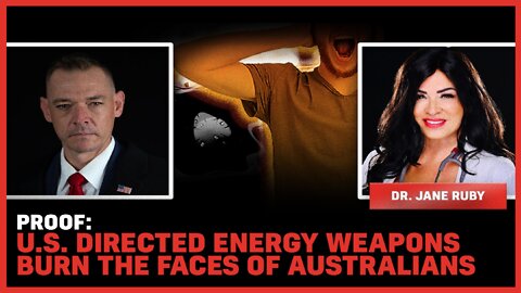 Proof: U.S. Directed Energy Weapons Burn The Faces Of Australians