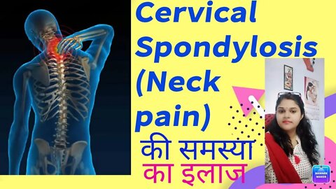 What is the best treatment for cervical spondylosis?#CervicalSpondylosis#drminakshisingh#homeopathy