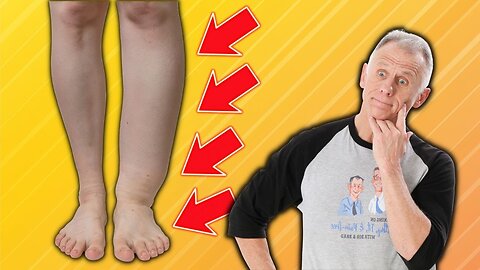 How To Fix Foot & Ankle Swelling; Everything You Need To Know!