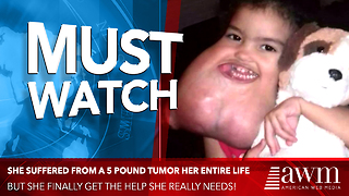 3-Year-Old Had 5-Pound Tumor Her Entire Life, Finally Gets Life-Changing Surgery