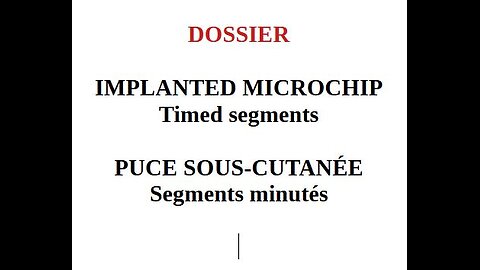 (Fran_Eng) FULL STORY: Implanted microchip _ DOSSIER: Puce sous-cutanée