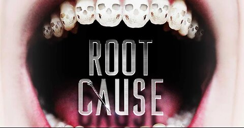 Root Cause