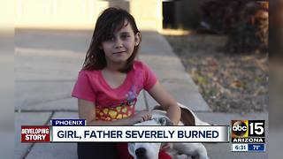 Neighbor speaks out after girl, father were severely burned in Phoenix