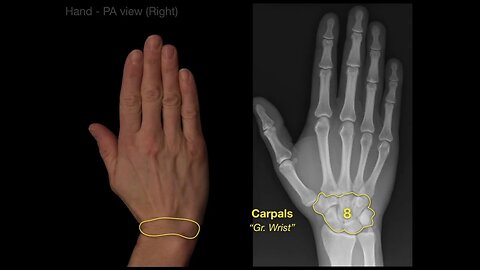 Anatomy of Hand X-rays_Revised