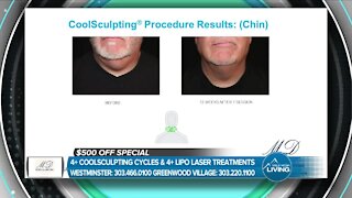 Look The Way You Want! // Coolsculpting & Lipo Laser MD Body & Med Spa