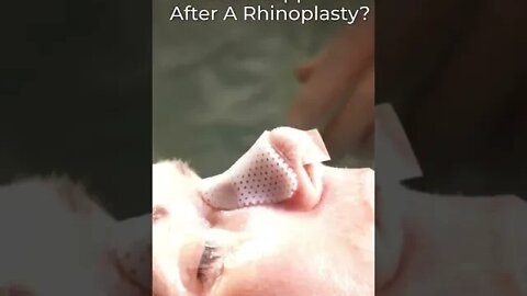 What Happens After A Nose Job? 💉👃 #plasticsurgery