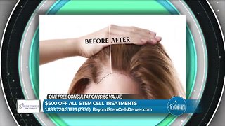 Beyond Stem Cells - Build Your Confidence by Learning about Hair Regrowth.