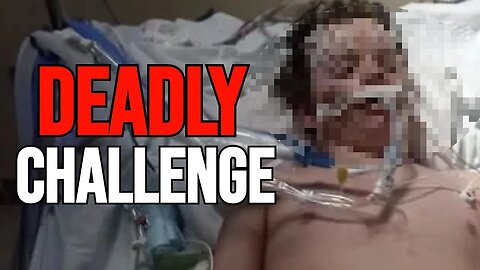 Teen Dies After Doing Benadryl Challenge