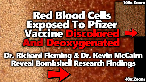 DISCOLORED & DEOXYGENATED: Blood Cells Exposed To Pfizer's Vaccine Lose Healthy Red Color & Oxygen?!