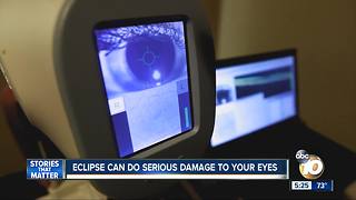 Eclipse can do serious damage to your eyes