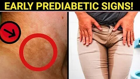 9 Early PREDIABETES Warning Signs You're Unaware Of